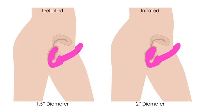 XR Brands Strap U Female Sex Toys Worlds 1st Remote Control Inflatable ErgoFit Strapless StrapOn