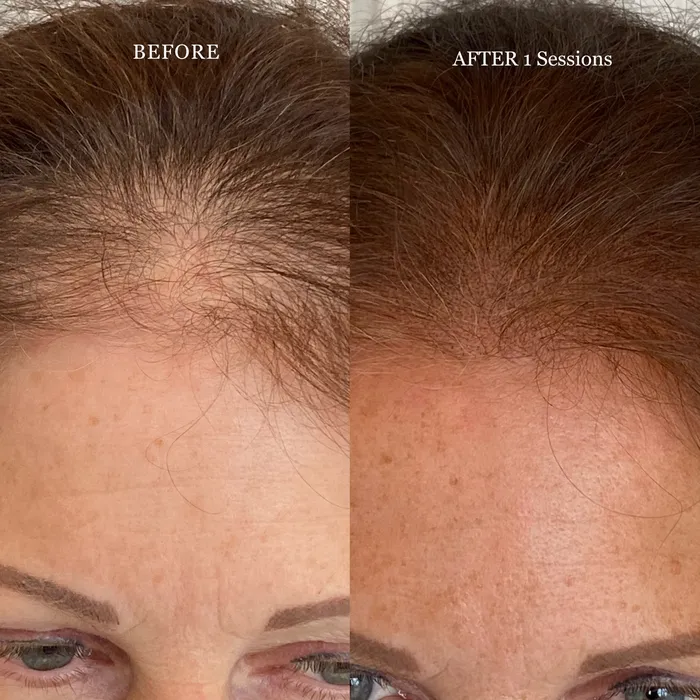 Perma Blend Anal Scalp Micro Dark Brown Perma Blend